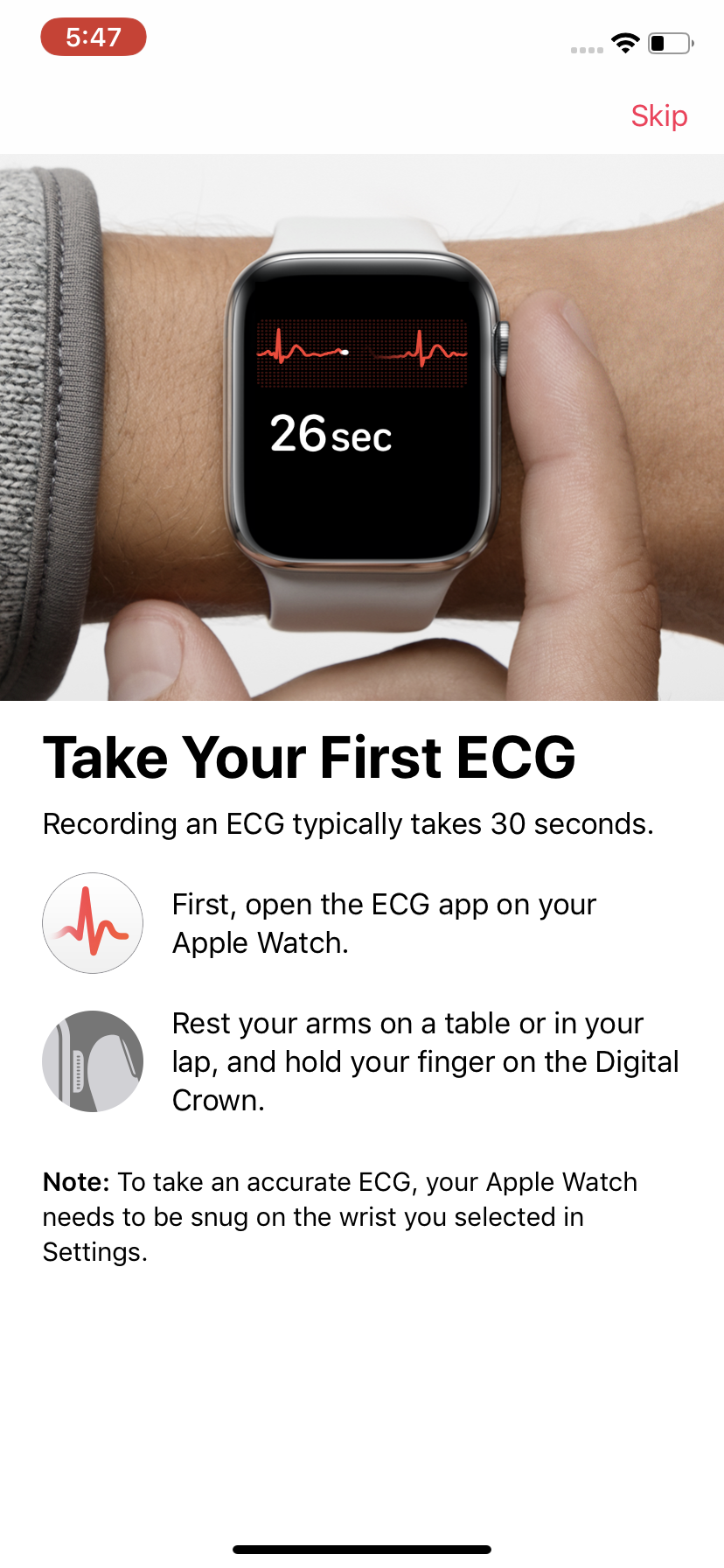 iwatch with ekg